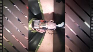 Electrostimulation + sperm ejaculation