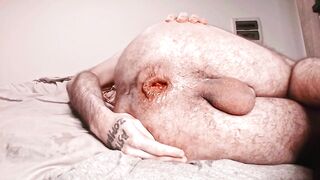 Pushing my prolapse out, fisting and showing closely my asshole