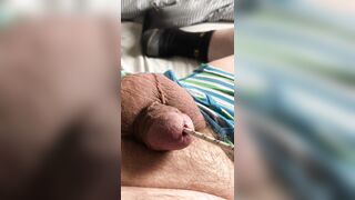 Screwdriver in urethra