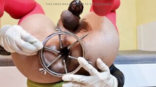Pakistani Bitch Stretches Asshole with Anal Speculum - 6 image
