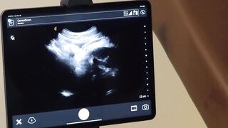 FunSizeBoys - Tall doctor and nurse breed tiny ultrasound bottom - 9 image