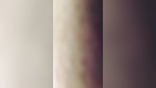 My stepmother gave me chickenpox