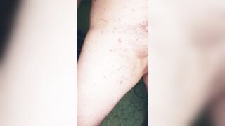 My stepmother gave me chickenpox