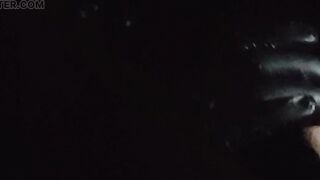 The doctor gave me a cream for penis pain