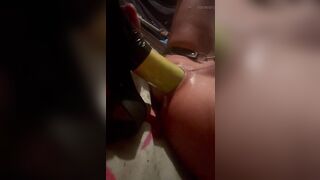 Stretch anus over size