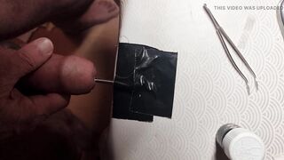 Deep probing with corrugated probe the balls are worked