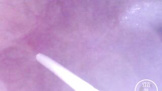 INSIDE POV: Inflating my Bladder with Air!