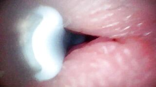 Intense endoscopic footage of sperm being pumped through the shaft of a man