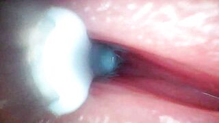 Intense endoscopic footage of sperm being pumped through the shaft of a man