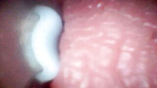 Intense endoscopic footage of sperm being pumped through the shaft of a man