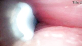 Intense endoscopic footage of sperm being pumped through the shaft of a man - 5 image