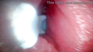 Intense endoscopic footage of sperm being pumped through the shaft of a man - 6 image