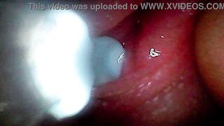 Intense endoscopic footage of sperm being pumped through the shaft of a man