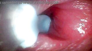 Intense endoscopic footage of sperm being pumped through the shaft of a man