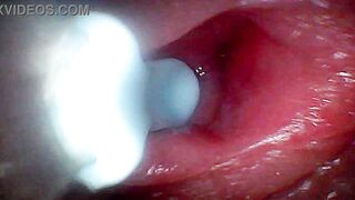 Intense endoscopic footage of sperm being pumped through the shaft of a man